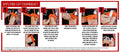 Step-by-step guide for applying a CAT tourniquet in a Bleeding Prevention Kit